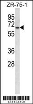 GPD2 Antibody