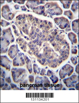 GPD2 Antibody