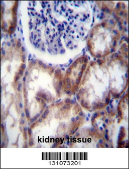 HYAL2 Antibody