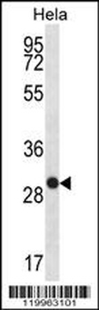 WFDC1 Antibody