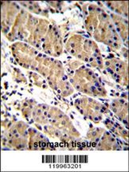 WFDC1 Antibody