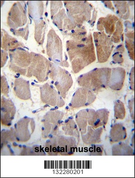 RPS6KC1 Antibody