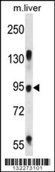 RASAL1 Antibody
