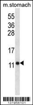 ATP5J Antibody