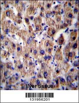 ATP5J Antibody