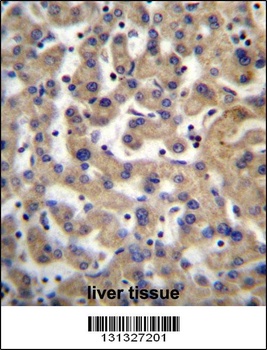 PDP1 Antibody