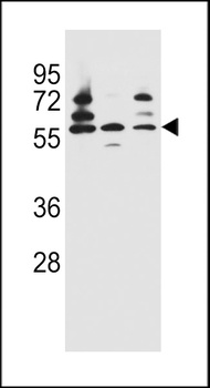 PDP1 Antibody