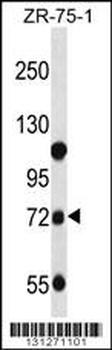 GUSB Antibody