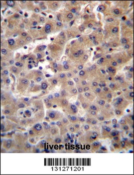 GUSB Antibody