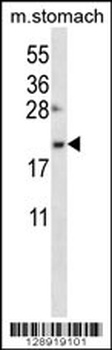 OSTC Antibody