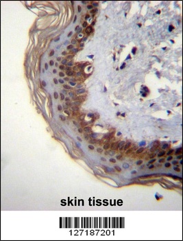 RBM42 Antibody