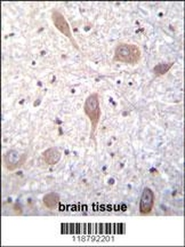 SPON1 Antibody