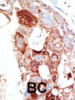 SENP6 Antibody