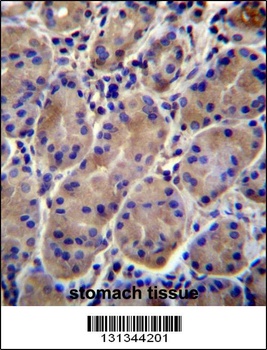 KCNJ13 Antibody