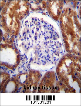 SLC12A6 Antibody