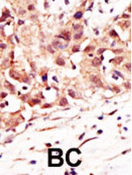 SENP5 Antibody