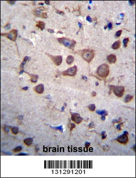 PIGA Antibody