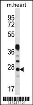 CRYBA1 Antibody