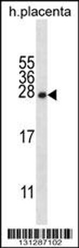 CRYBA1 Antibody