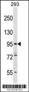 ESPNL Antibody