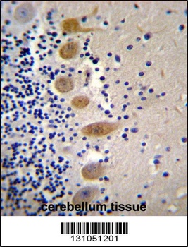 MST1 Antibody