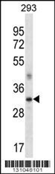 SFRP2 Antibody