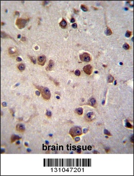 CHST6 Antibody