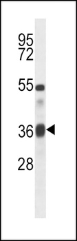 TGFB1 Antibody