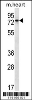 PARP2 Antibody