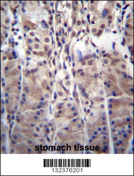 MDM1 Antibody