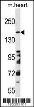 DCC Antibody
