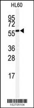 SENP2 Antibody