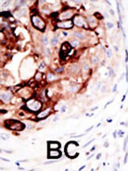 SENP2 Antibody