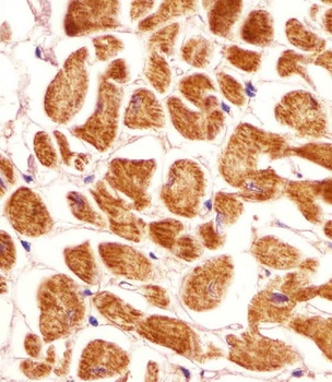 PCCA Antibody