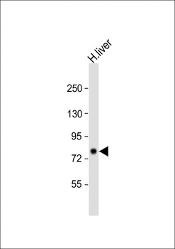 PCCA Antibody