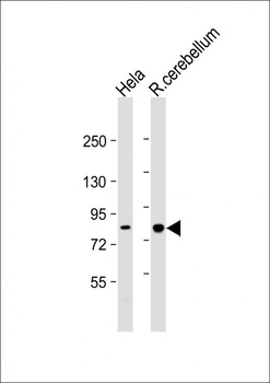 PCCA Antibody