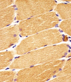 DVL1 Antibody