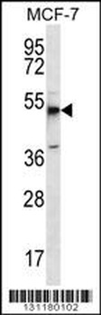 MBOAT4 Antibody