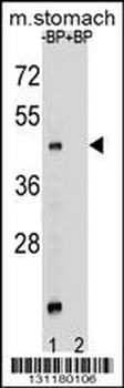 MBOAT4 Antibody