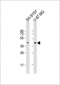 GPR45 Antibody