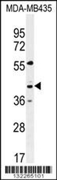 GPR45 Antibody