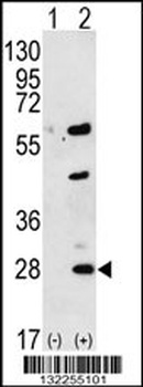 GREM1 Antibody