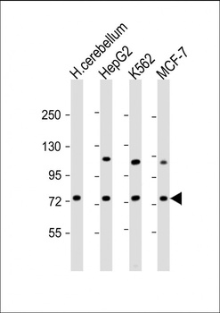 SMPD1 Antibody