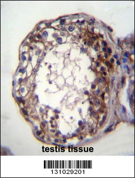 SMPD1 Antibody