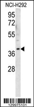 OR2AK2 Antibody