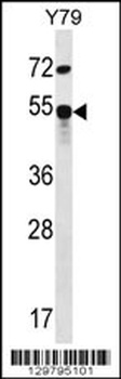ZFP14 Antibody