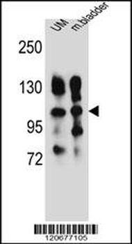 ITGA5 Antibody