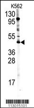 PRMT8 Antibody