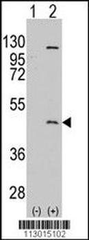 PRMT8 Antibody