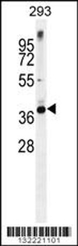 STX16 Antibody